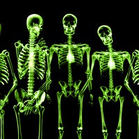 xray